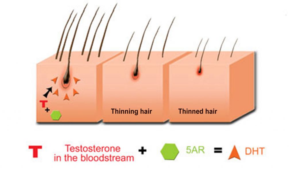 thinning hair remedies